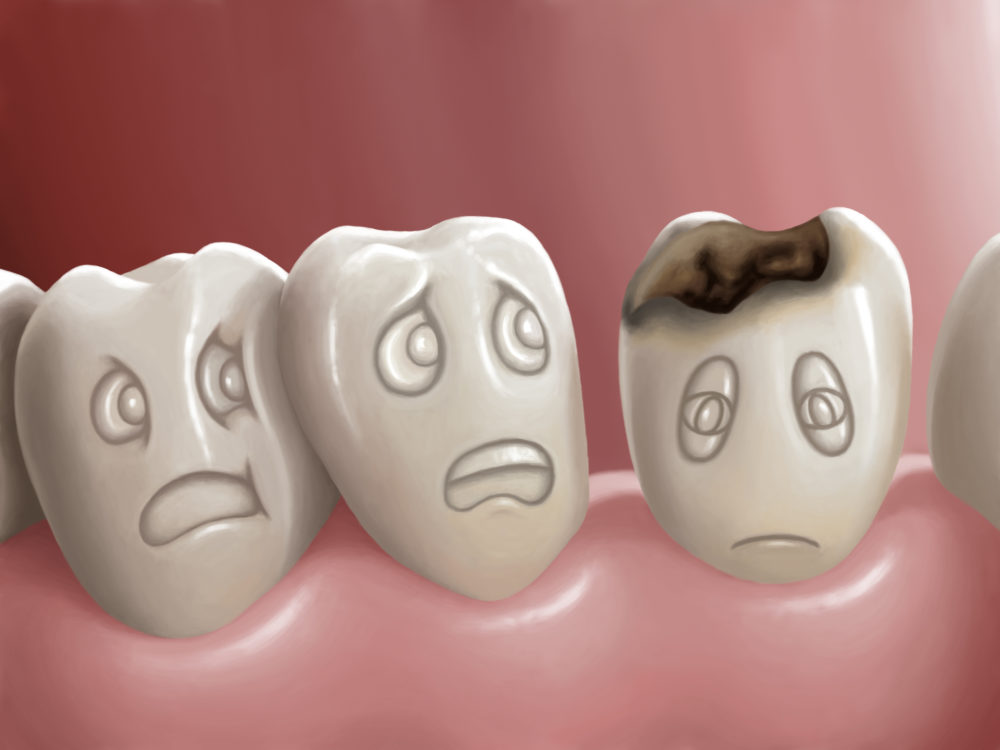 How to Save a Dying Tooth Naturally?
