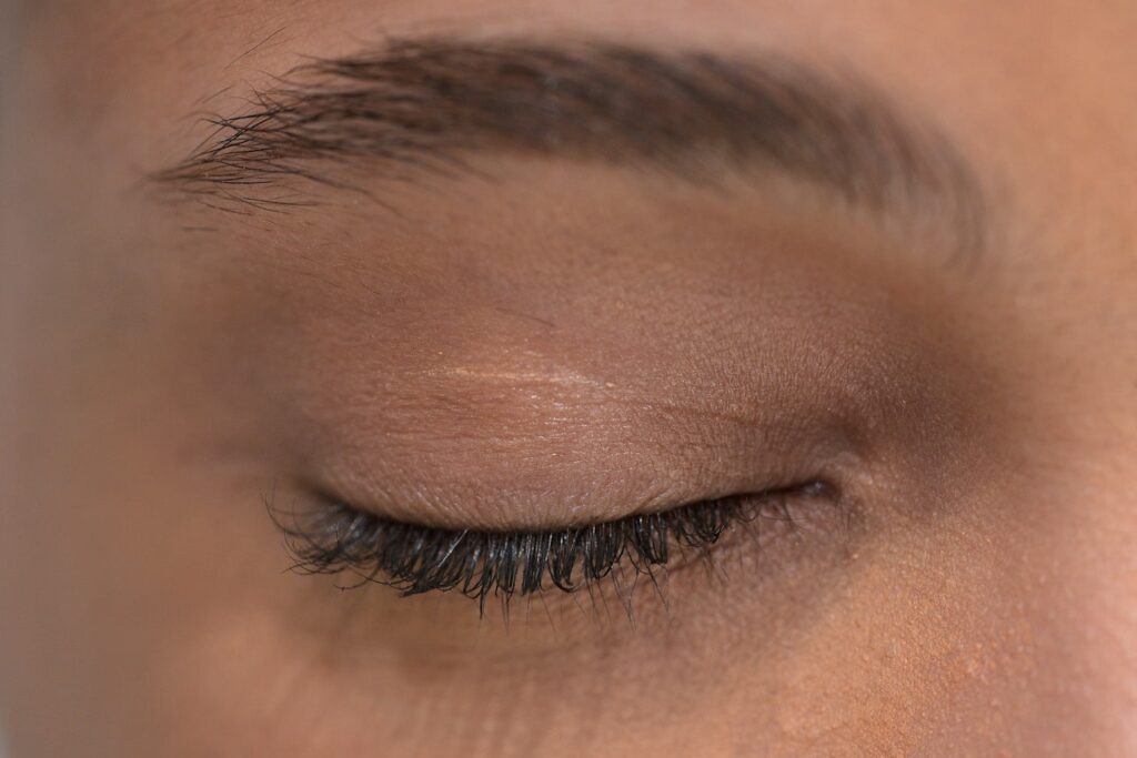 Are Dark Eyelids a Health Warning